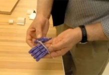 Tạo ngón tay giả từ máy in 3D