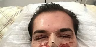 phẫu thuật thành búp bê