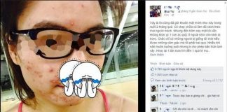 dị ứng mỹ phẩm 