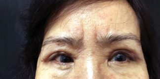 phẫu thuật thẩm mỹ 