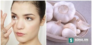 Tỏi không phải là thức ăn lý tưởng dành cho những người bị bệnh về mắt. (Ảnh: nguồn internet).