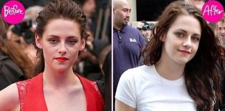 Hư ngực vì không biết cách chăm sóc