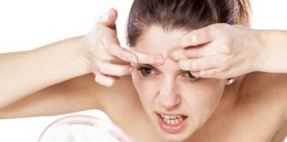 dị ứng mỹ phẩm 