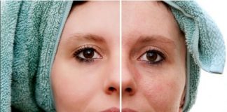 5 cách trị nám da siêu hiệu quả của phụ nữ Hàn Quốc