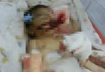 Bé sơ sinh bị chuột cắn chết trong bệnh viện