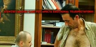 Ngắm da bụng chảy xệ khủng khiếp sau khi giảm 135kg