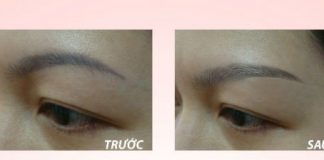 Phương pháp xóa vết phun thêu lông mày thành công nhất có thể bạn chưa biết