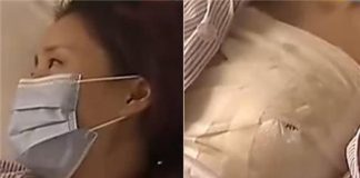 phẫu thuật ngực hỏng 