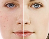 w64pqW_3122_chamecuacon