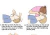 Xử trí đúng cách khi gặp nạn gây đứt chi Sơ cứu trong những trường hợp khẩn cấp