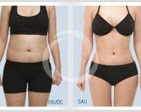 Giảm cân nhanh chỉ 3 phút mỗi ngày khi xoa bụng đúng cách