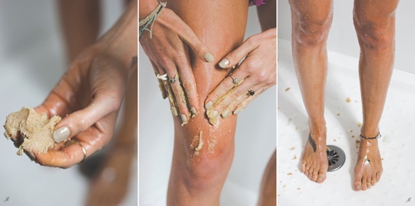 5 cách phòng ngừa và điều trị rạn da