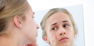 trị mụn trứng cá 