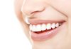 trắng răng 