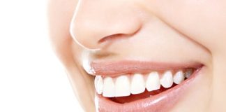 trắng răng 