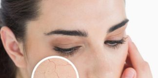 bí quyết không bị nẻ 