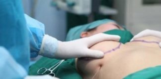 cách phát hiện nâng ngực 