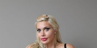 cắt xương sườn 