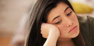 sai lầm khi trị mụn 