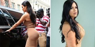 phẫu thuật thẩm mỹ 