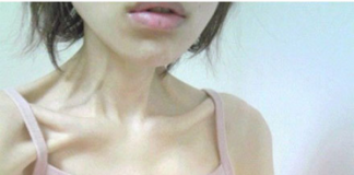 Phát hoảng: Thiếu nữ mang thân hình “xác khô di động”