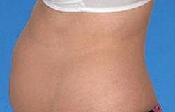 Cách giảm cân sau sinh của vợ tôi