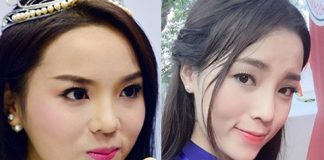 Kỳ duyên thẩm mỹ 