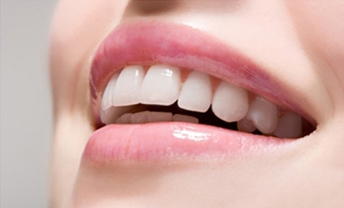 trắng răng