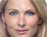 Những điều bạn chưa biết về nếp nhăn