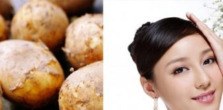 trị mụn đầu đen 