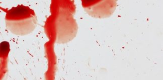 dùng máu làm đẹp 