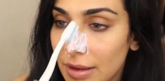 trị mụn đầu đen 