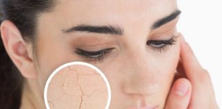 Cách chữa da khô nứt nẻ hiệu quả hơn cả dùng thuốc
