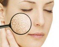 Nhận biết ngay khi làn da của bạn bị thiếu độ ẩm nghiêm trọng
