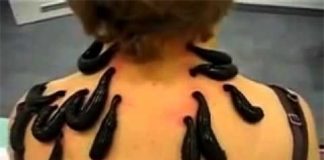 Khóc thét với những phương pháp chữa bệnh “quái dị” nhất thế giới