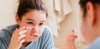 Cách chăm sóc da cho tuổi teen - 1