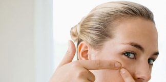 nhung-dieu-tuyet-doi-khong-nen-lam-khi-bi-mun-trung-ca-1