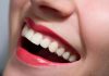 Làm sao để có hàm răng trắng sáng - 1