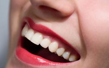 Làm sao để có hàm răng trắng sáng - 1