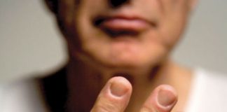 Thuốc có ảnh hưởng đến xương của bạn hay không? - 1