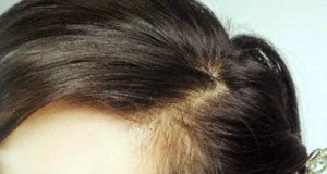 Hướng dẫn những kiểu kết hợp phụ kiện làm đẹp cho tóc nhân ngày 8/3 - 2