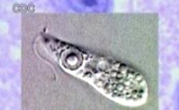 Triệu chứng và cách phòng bệnh amip “ăn não”