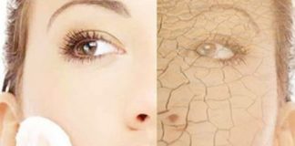 Một số bệnh ảnh hưởng tới làn da của bạn