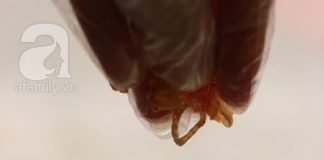 Nộm bí đao thanh mát cho ngày nắng lên 14