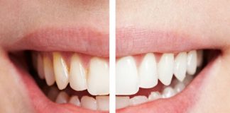 cong-dung-cua-vo-chuoi-1