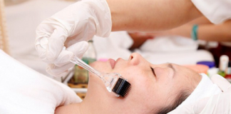 Thực hư về phương pháp lăn kim trị mụn đang ‘gây sốt’1