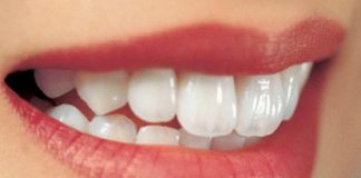 Hướng dẫn 5 bí quyết cho hàm răng trắng sáng