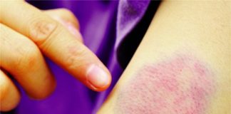 Điểm danh những bệnh ung thư dễ gặp nhất ở lứa tuổi 20  - 1