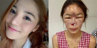 Sốc trước gương mặt "nát bét" của hot girl Thái Lan