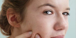 Bỏ ngay những thói quen xấu này nếu không muốn da bị 'tàn phá'